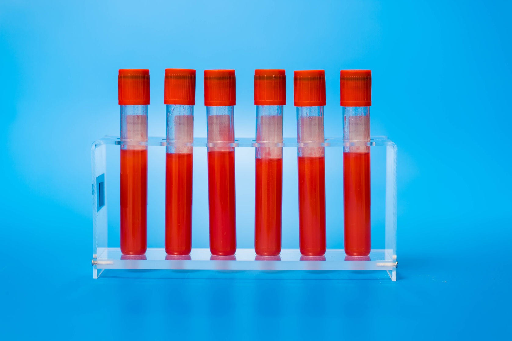 How To Read Blood Work Chart